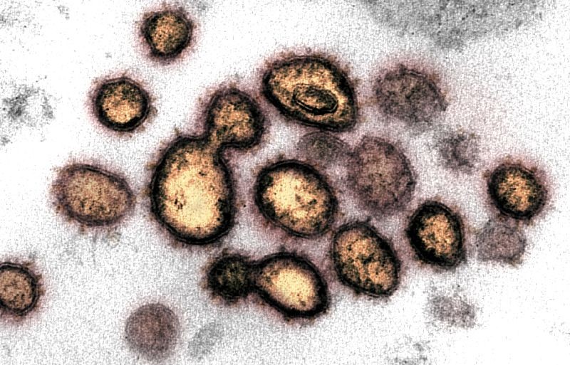 This transmission electron microscope image shows SARS-CoV-2, also known as novel coronavirus, the virus that causes COVID-19, isolated from a patient in the U.S. Virus particles are shown emerging from the surface of cells cultured in the lab. The spikes on the outer edge of the virus particles give coronaviruses their name, crown-like. NIAID-RML/Handout via REUTERS.