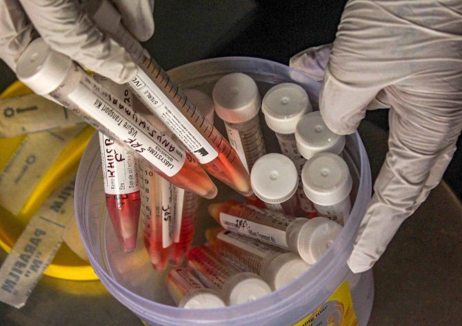 A health worker arranges samples for COVID-19 Real-Time Polymerase Chain Reaction (RT-PCR) test at Urban Primary Health Centre in Gurugram. Photograph: PTI Photo