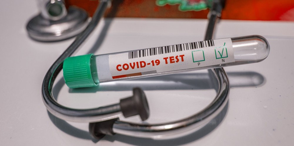 The Department of Health & Family Welfare Nagaland issues guideline on rational use of COVID-19 Testing. (Image by fernando zhiminaicela from Pixabay)