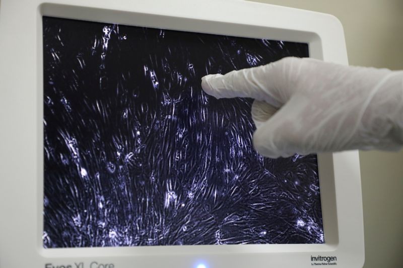 A researcher points at a microscope screen showing Sumatran Rhinoceros cells at a laboratory in International Islamic University, in Kuantan, Malaysia on June 30, 2020. (REUTERS File Photo)