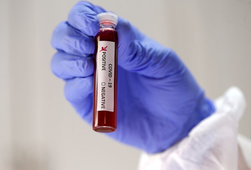 Fake blood is seen in test tubes labelled with the coronavirus (COVID-19) in this illustration taken on March 17, 2020. (REUTERS File Photo)