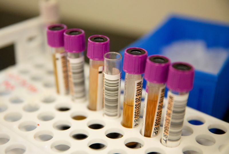 Convalescent plasma samples in vials are seen before being tested for COVID-19 antibodies at the Bloodworks Northwest Laboratory during the coronavirus disease (COVID-19) outbreak in Renton, Washington, U.S. September 9, 2020. (REUTERS File Photo)