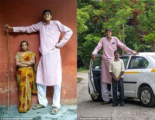 Problems growing taller for 8-feet tall man from Uttar Pradesh. (IANS Photo)