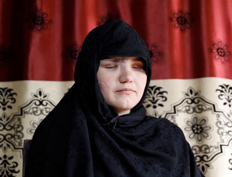 Khatera, 33, an Afghan police woman who was blinded after a gunmen attack in Ghazni province, speaks during an interview in Kabul, Afghanistan October 12, 2020. REUTERS/Mohammad Ismail