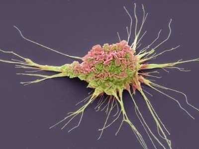 Image Source: IANS News