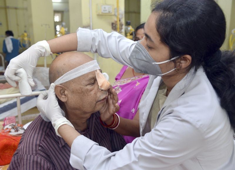 A doctor treats a patient infected with black fungus at NSCB Medical College and Hospital, in Jabalpu. (PTI File Photo)